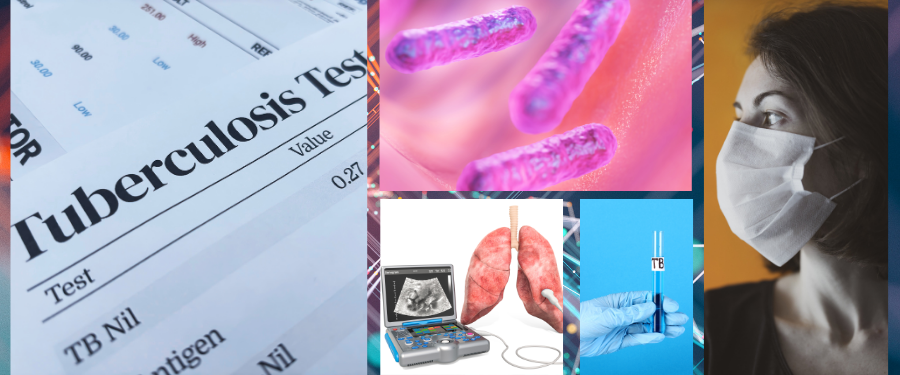 A mashup of the following: Picture of a tuberculosis test; Closeup of bacteria; Lungs with testing equipment; a test tube labeled 